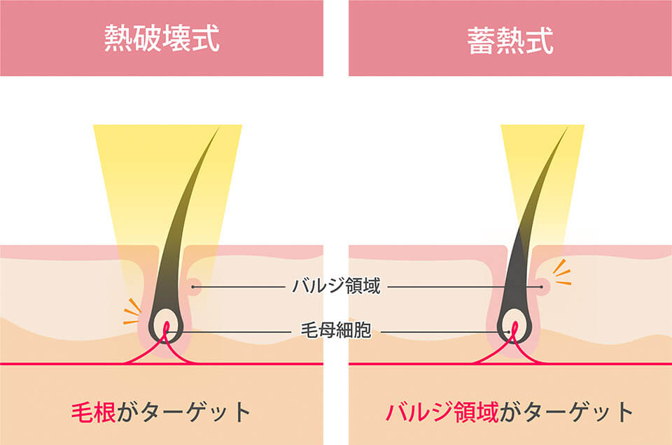 熱破壊式と蓄熱式の違い